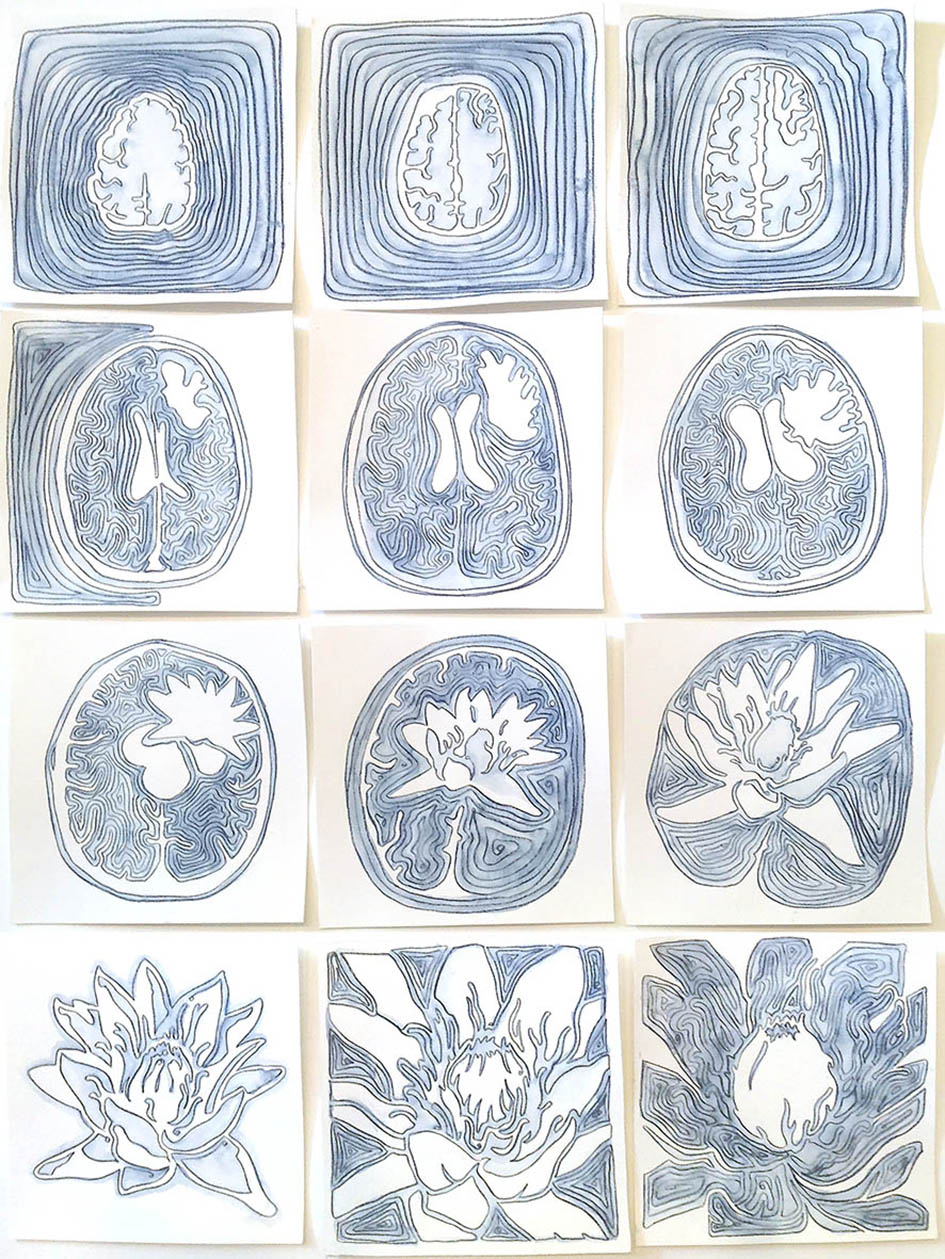 CH5 2016 brain cross section to lilly 8cm
